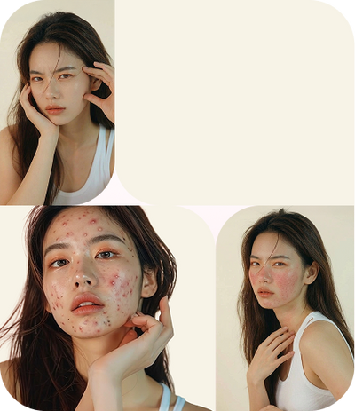 TÜM CİLT SORUNLARI